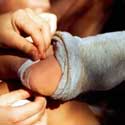 How to Prevent Blisters
